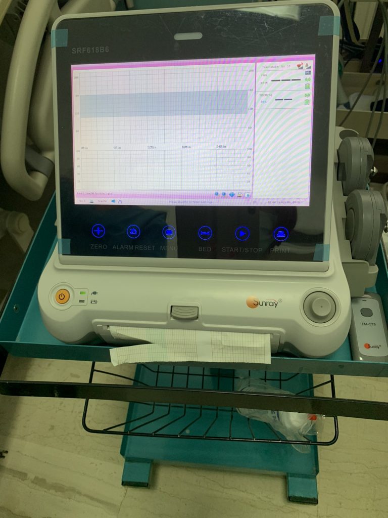 ΚΑΡΔΙΟΤΟΓΡΑΦΟΣ 1