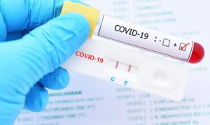 pcr covid test travel europe